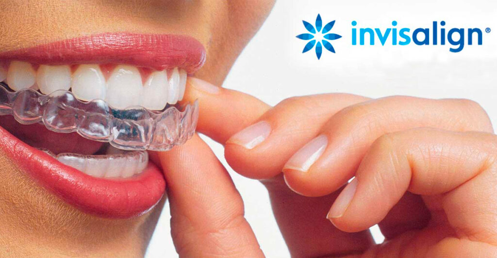 Clinica dental Alsina Barcelona
