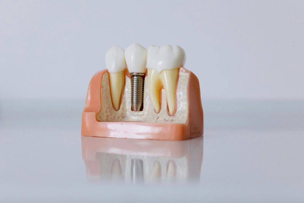 Clinica dental Alsina Barcelona
