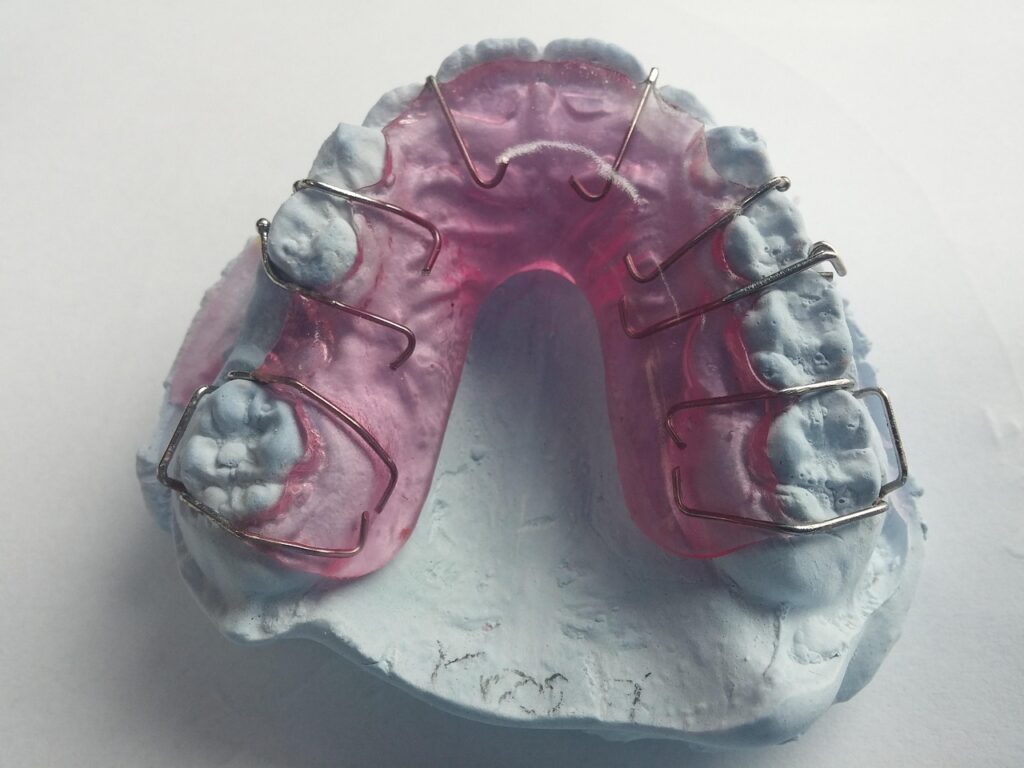 Clinica dental Alsina Barcelona