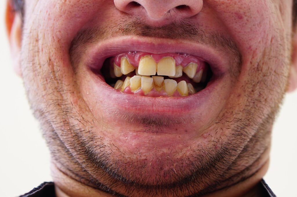 Clinica dental Alsina Barcelona