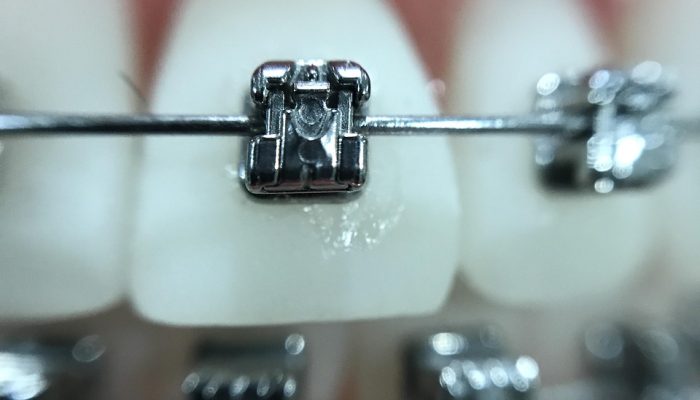 Clinica dental Alsina Barcelona